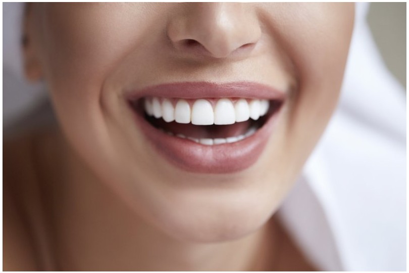 Digital Smile Design in Turkey