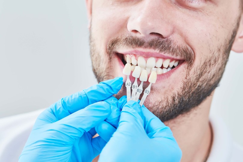 Fixed and Removable Dentures (Prosthodontics)