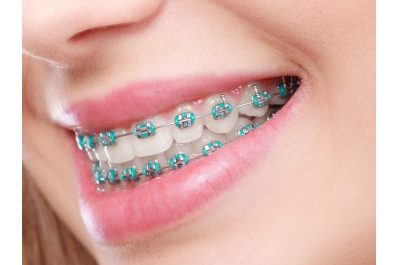 Orthodontics